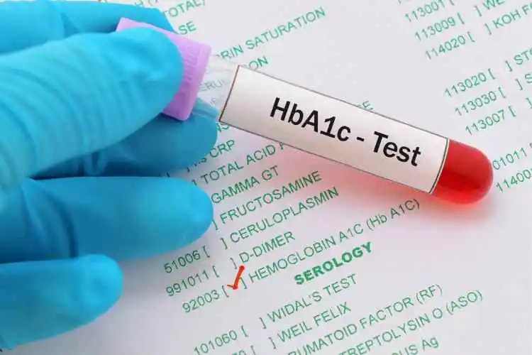 Importance of HbA1c Test in Diabetes Monitoring